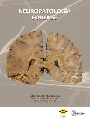 Neuropatología forense - ebook
